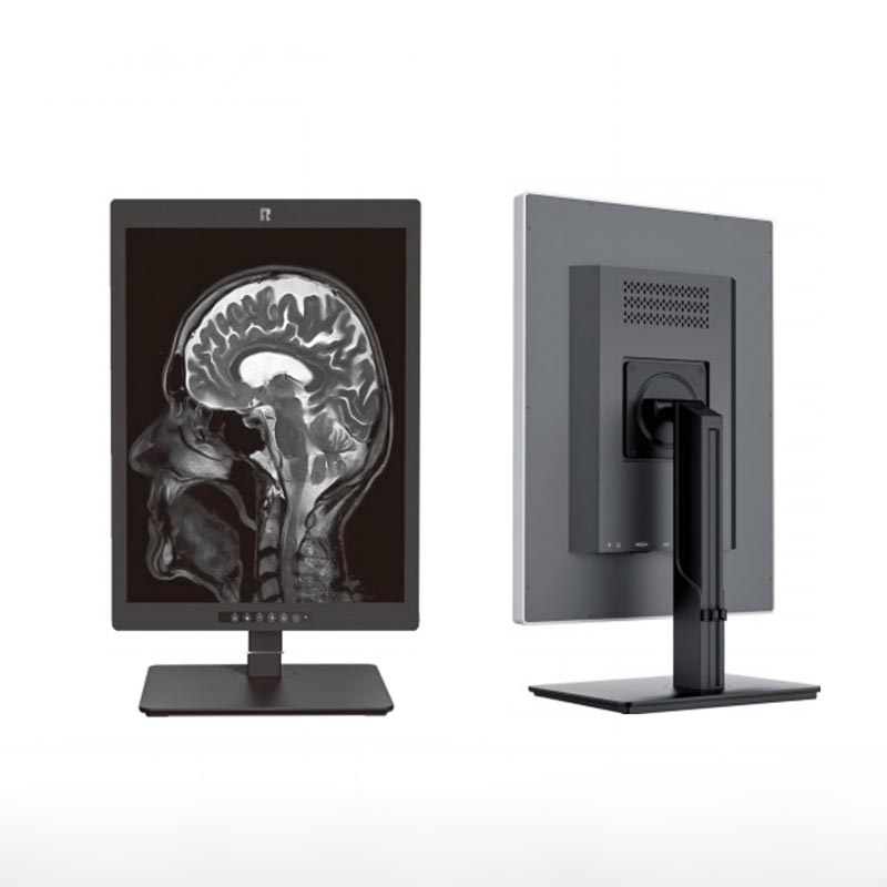 20.1-Inch 2MP High-Definition Medical Display