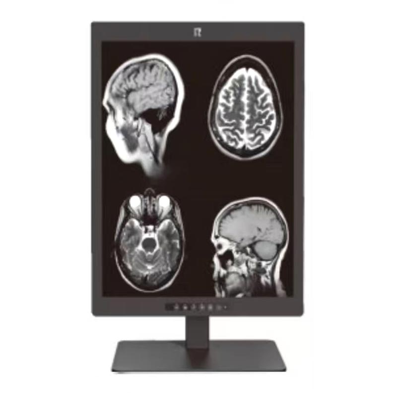21.3-Inch 3MP High-Definition Medical Display