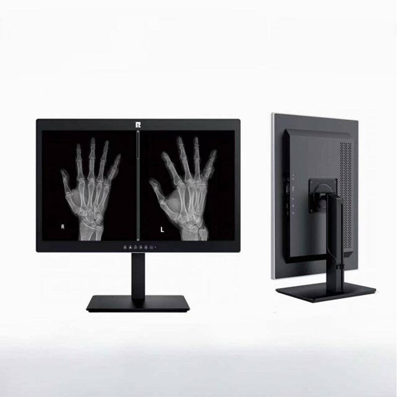 24-Inch 2MP HD Medical Display