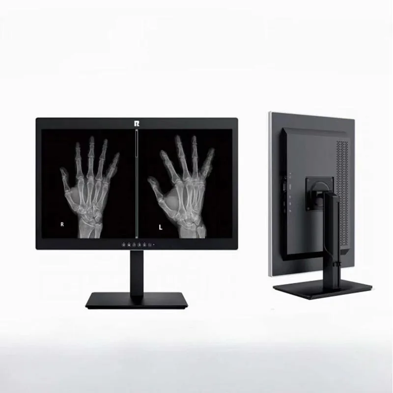 24-inch 2MP Medical Diagnostic Display