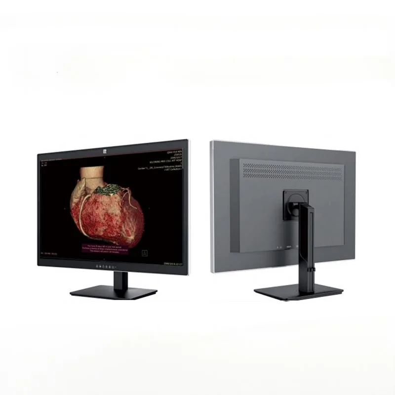30-inch 6MP Medical Diagnostic Monitor