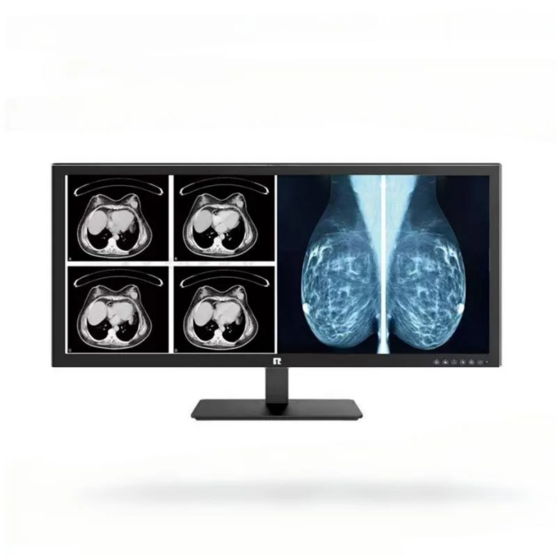 34-inch 5MP Medical Diagnostic Monito