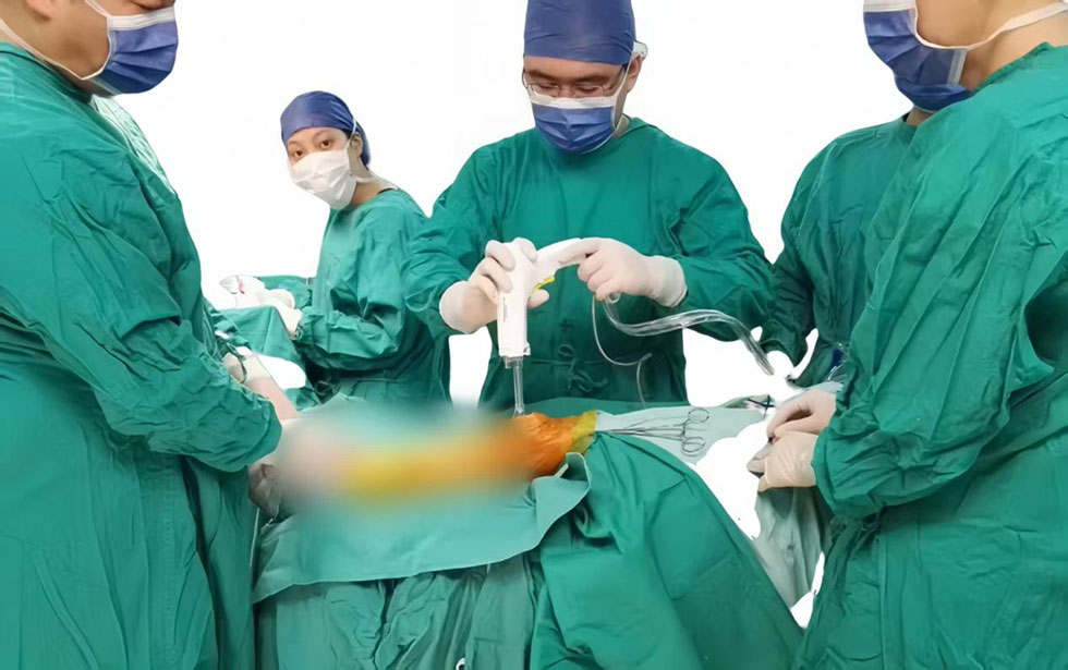 Medical Pulse Irrigator