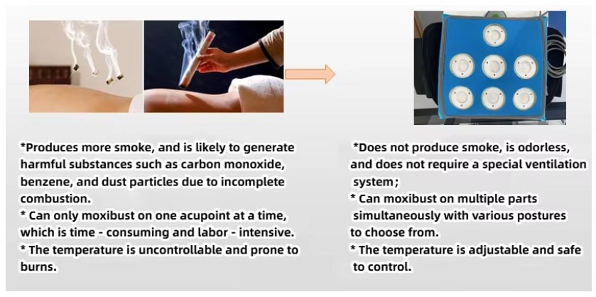Electric Moxibustion Therapy Device