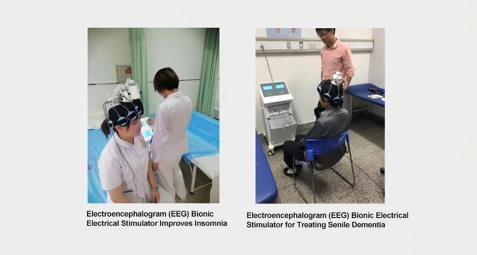 Electroencephalographic Bionic Stimulator
