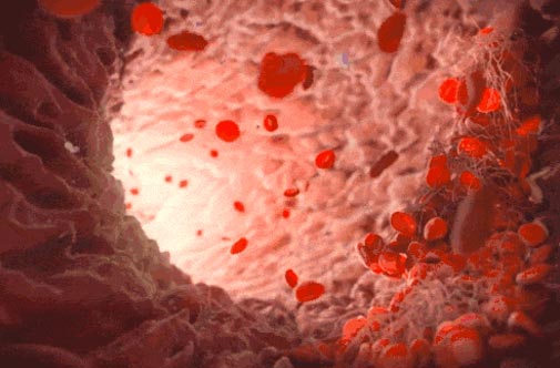 Constant Temperature Paraffin Therapy Device