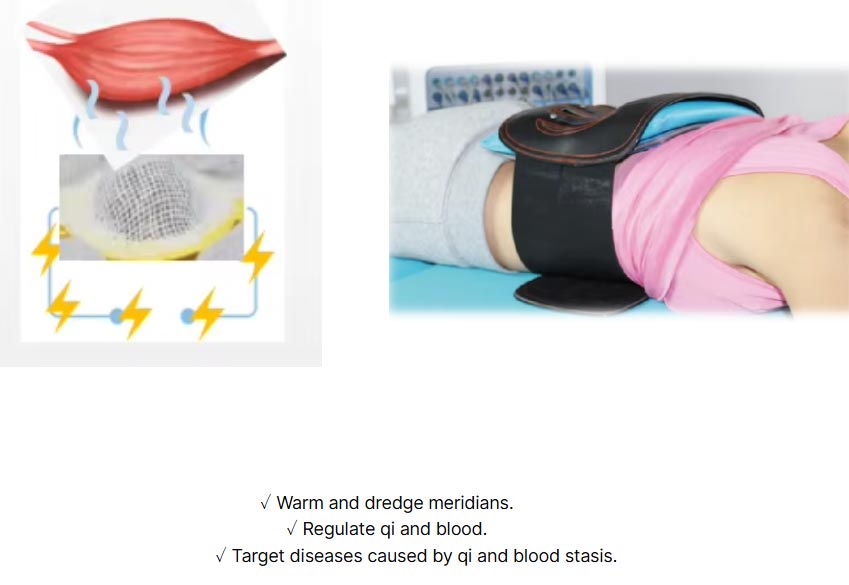 Electric Moxibustion Therapy Device