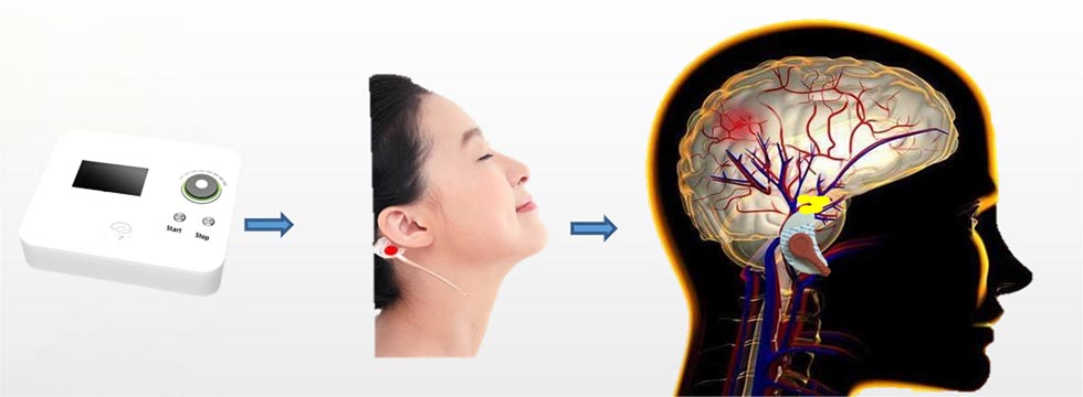 Electroencephalographic Bionic Stimulator