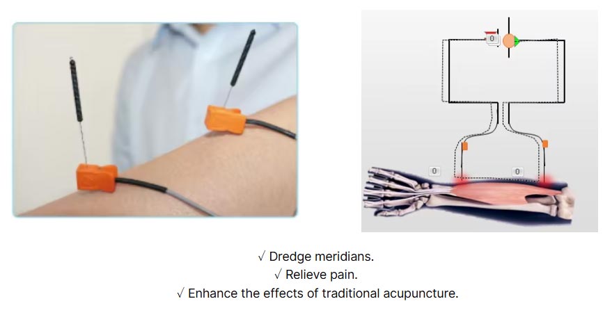 Electric Moxibustion Therapy Device