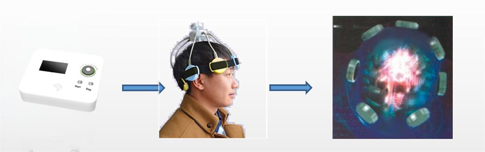 Electroencephalographic Bionic Stimulator