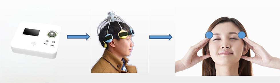 Electroencephalographic Bionic Stimulator