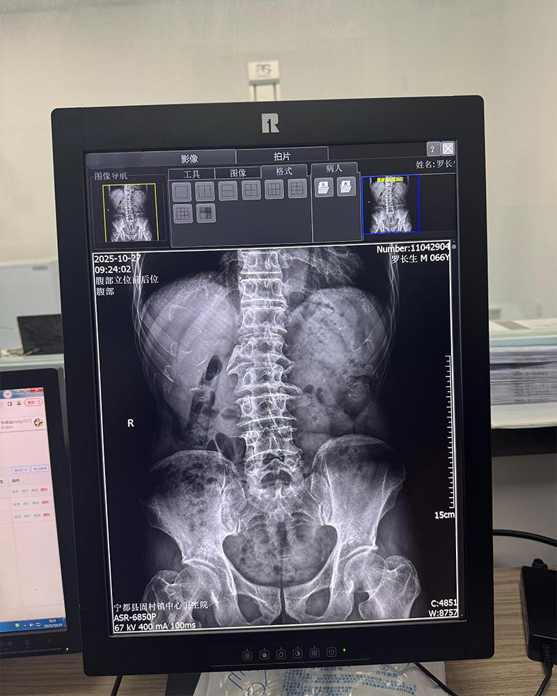 20.1-Inch 2MP High-Definition Medical Display