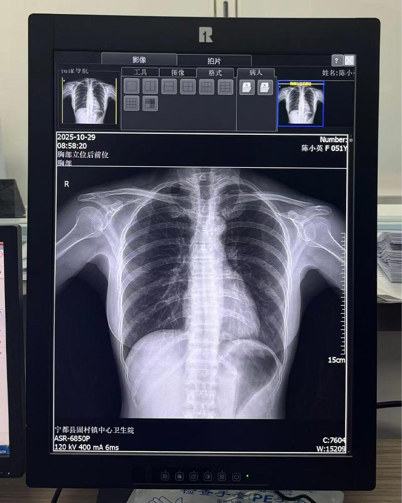 20.1-Inch 2MP High-Definition Medical Display