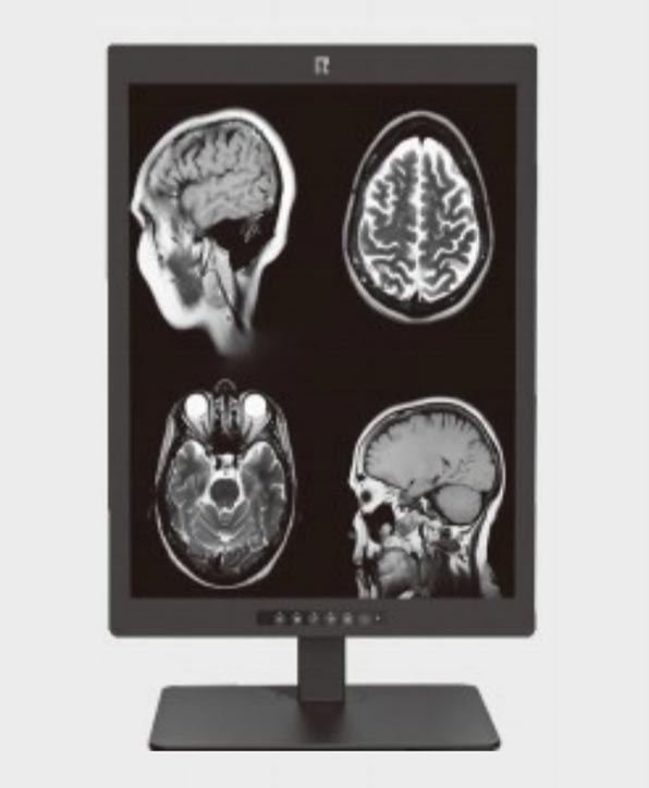 20.1-Inch 2MP High-Definition Medical Display