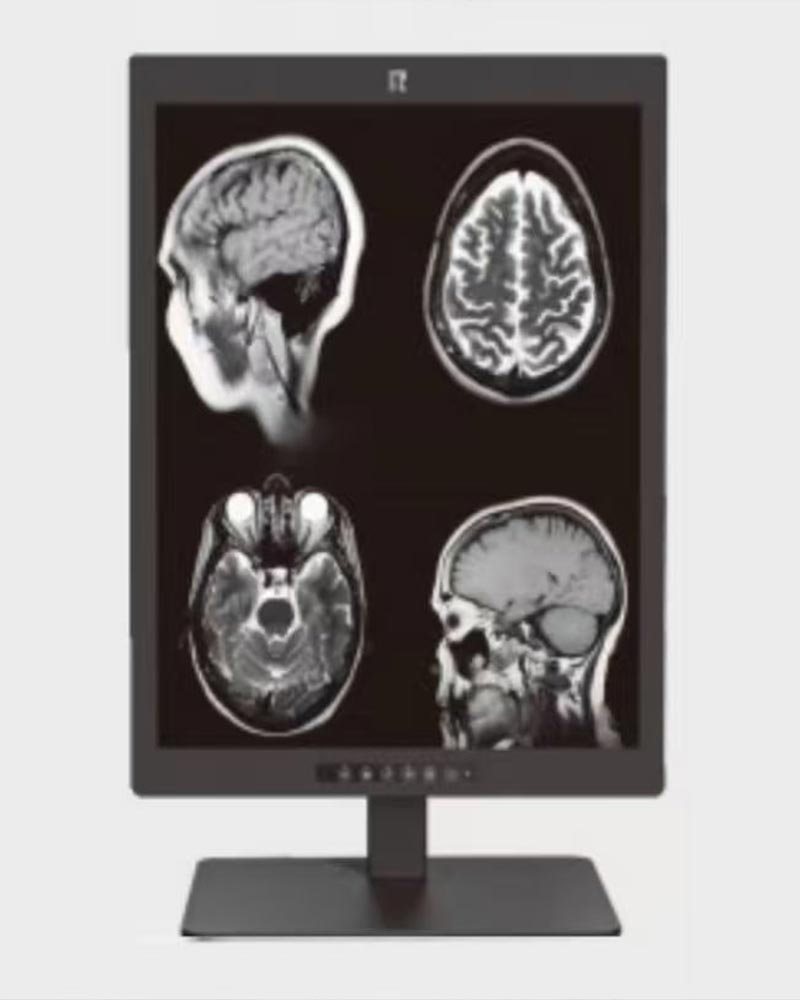 21.3-Inch 3MP High-Definition Medical Display