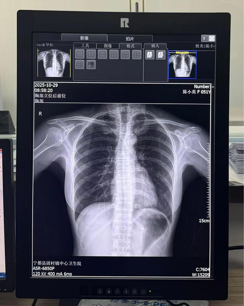 21.3-Inch 3MP High-Definition Medical Display