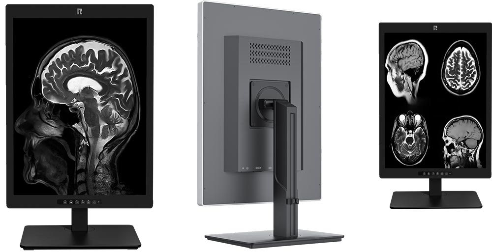 21.3-Inch 3MP High-Definition Medical Display