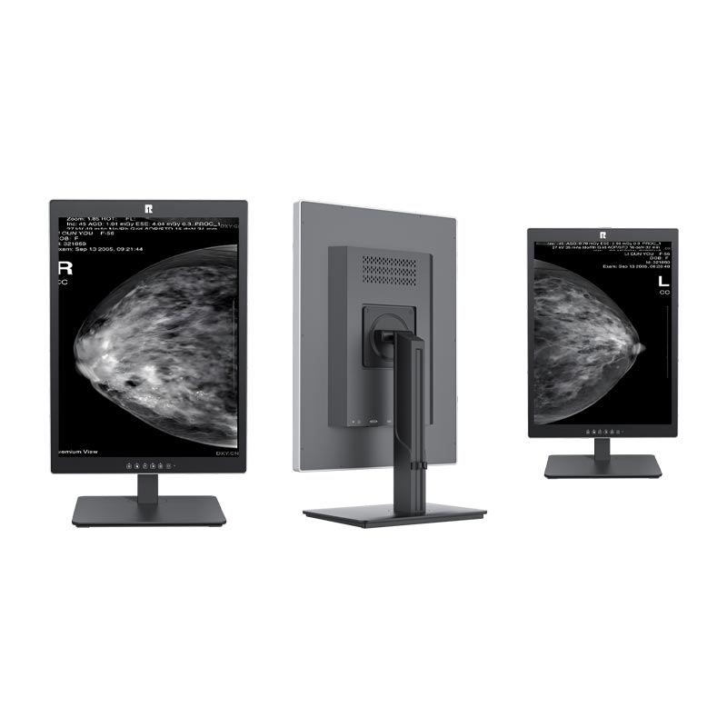 21.3-Inch 5MP Medical Diagnostic Display