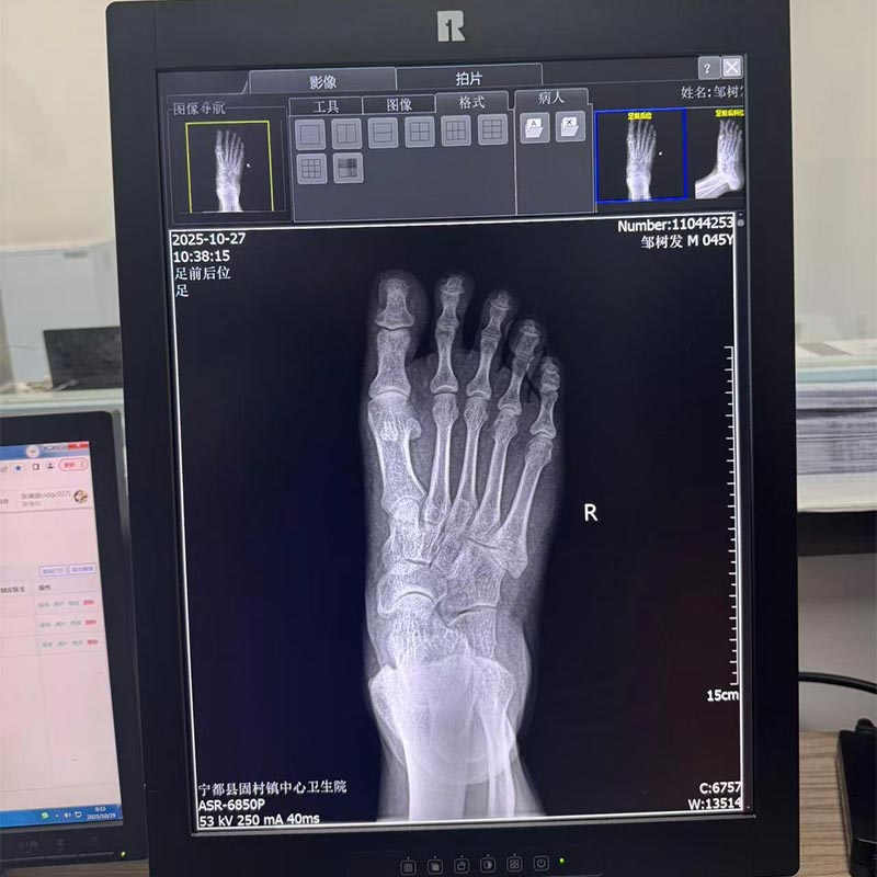 21.3-Inch 5MP Medical Diagnostic Display