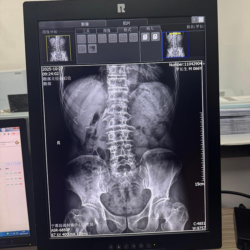 21.3-Inch 5MP Medical Diagnostic Display