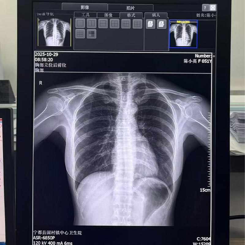 21.3-Inch 5MP Medical Diagnostic Display