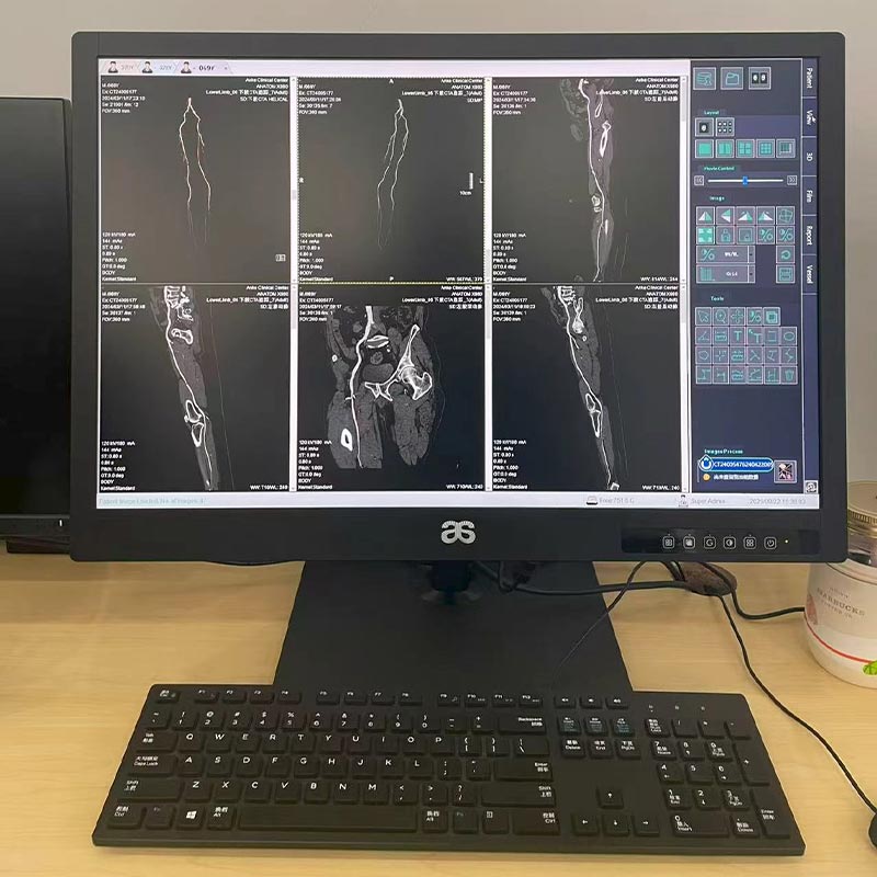 24-Inch 2MP HD Medical Display