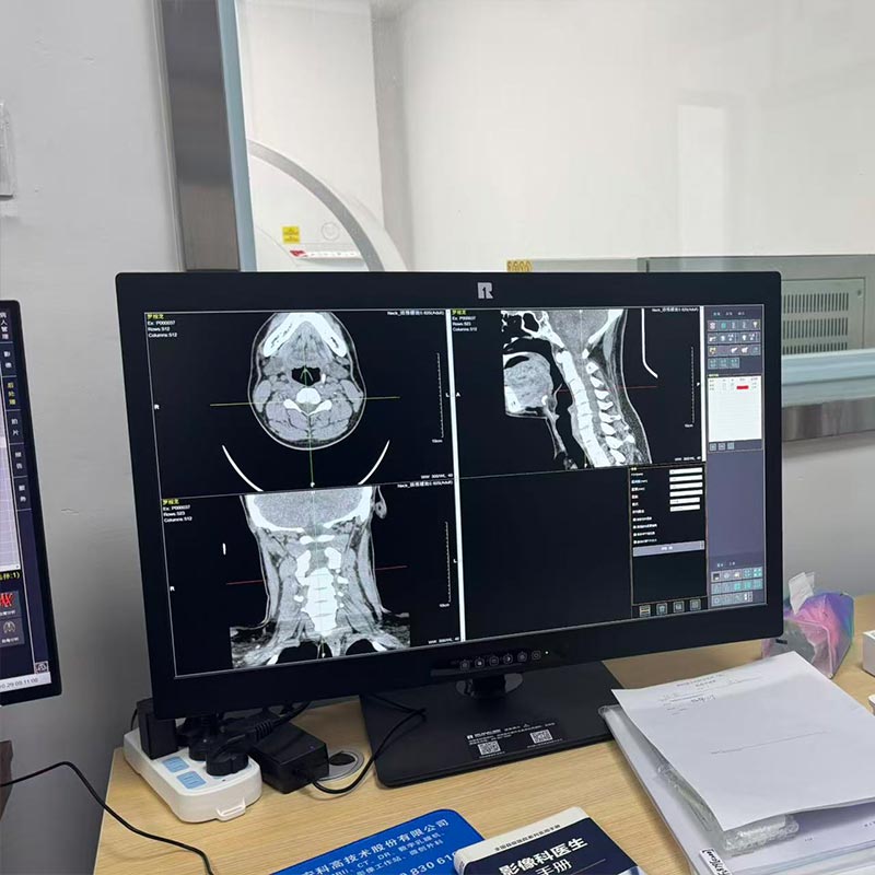 24-Inch 2MP HD Medical Display