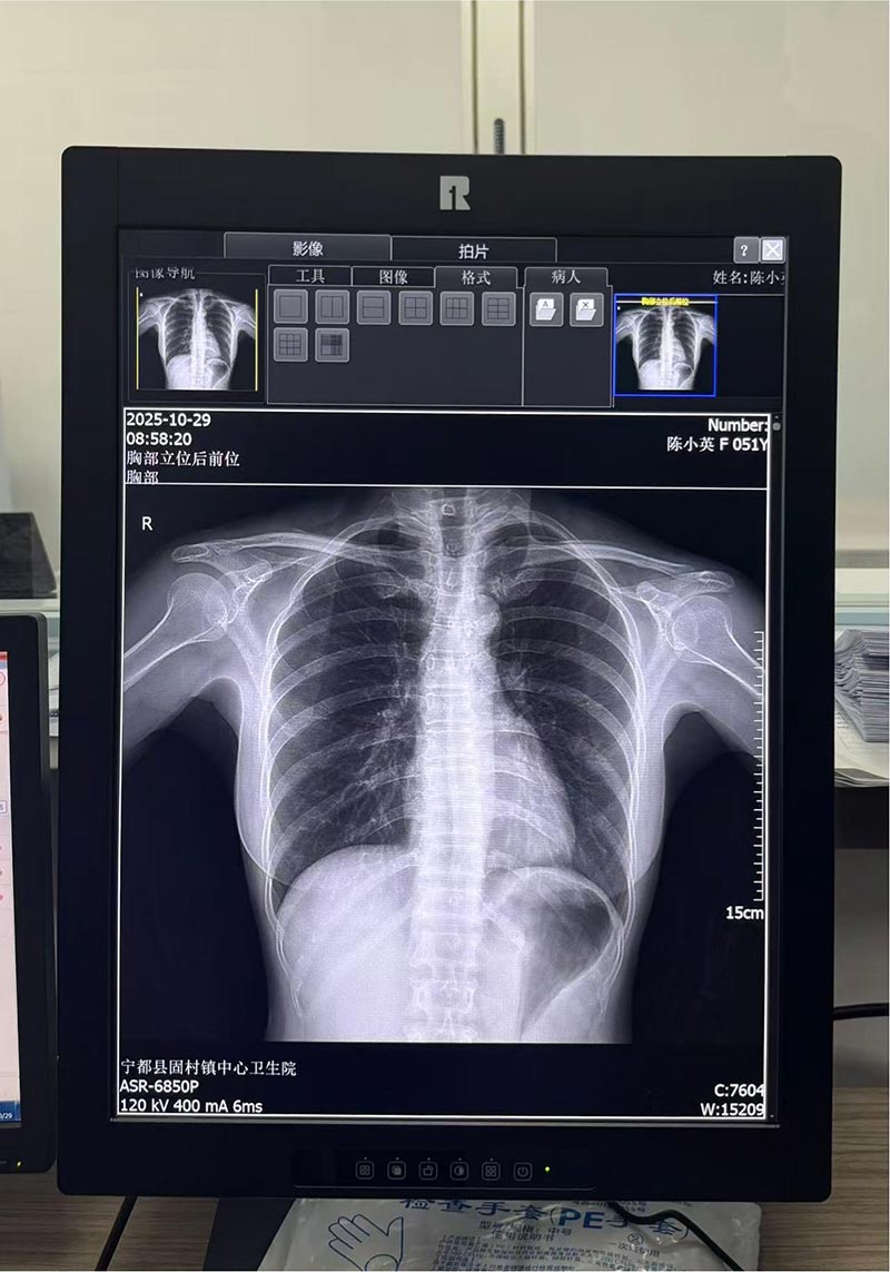 27 inch 4K Endoscopic Display