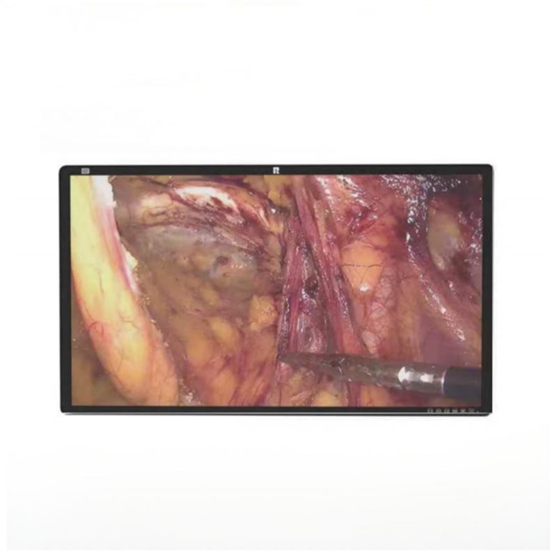 55-inch 4K Endoscopic Display