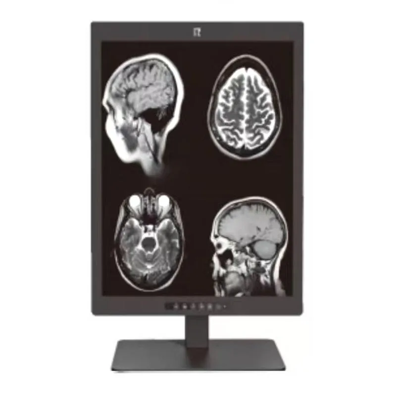 21.3-inch 3MP Medical Diagnostic Display