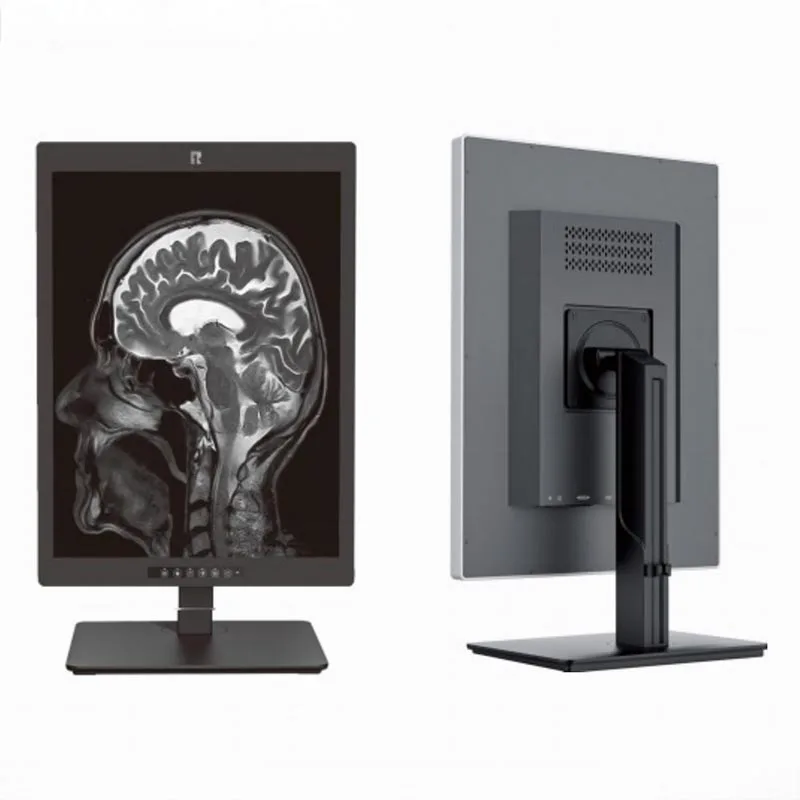 21.3-inch 3MP Medical Diagnostic Display