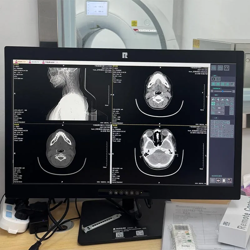 24-inch 2MP Medical Diagnostic Display