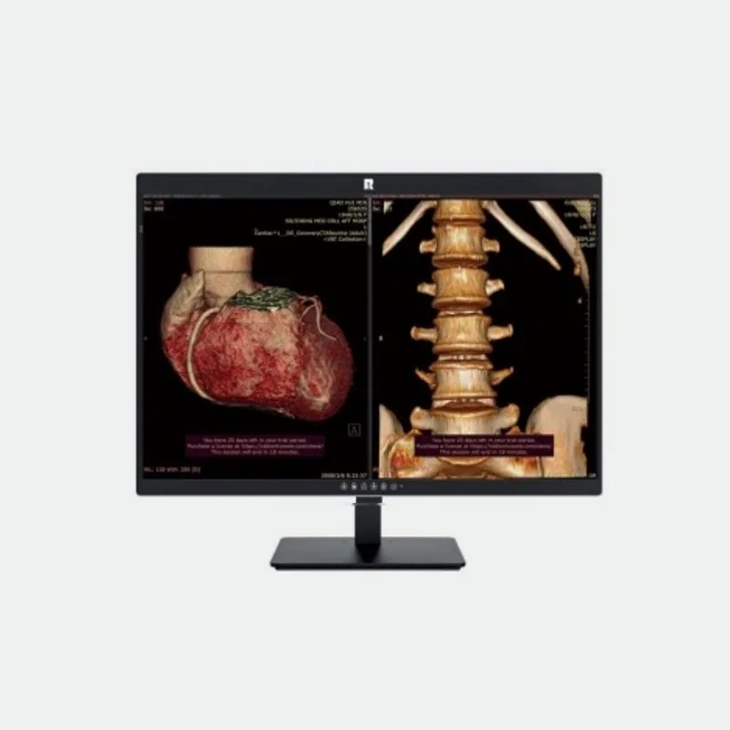 30-inch 6MP Medical Diagnostic Display
